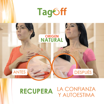 Tag Off Solución Verrugas y Carnosidades